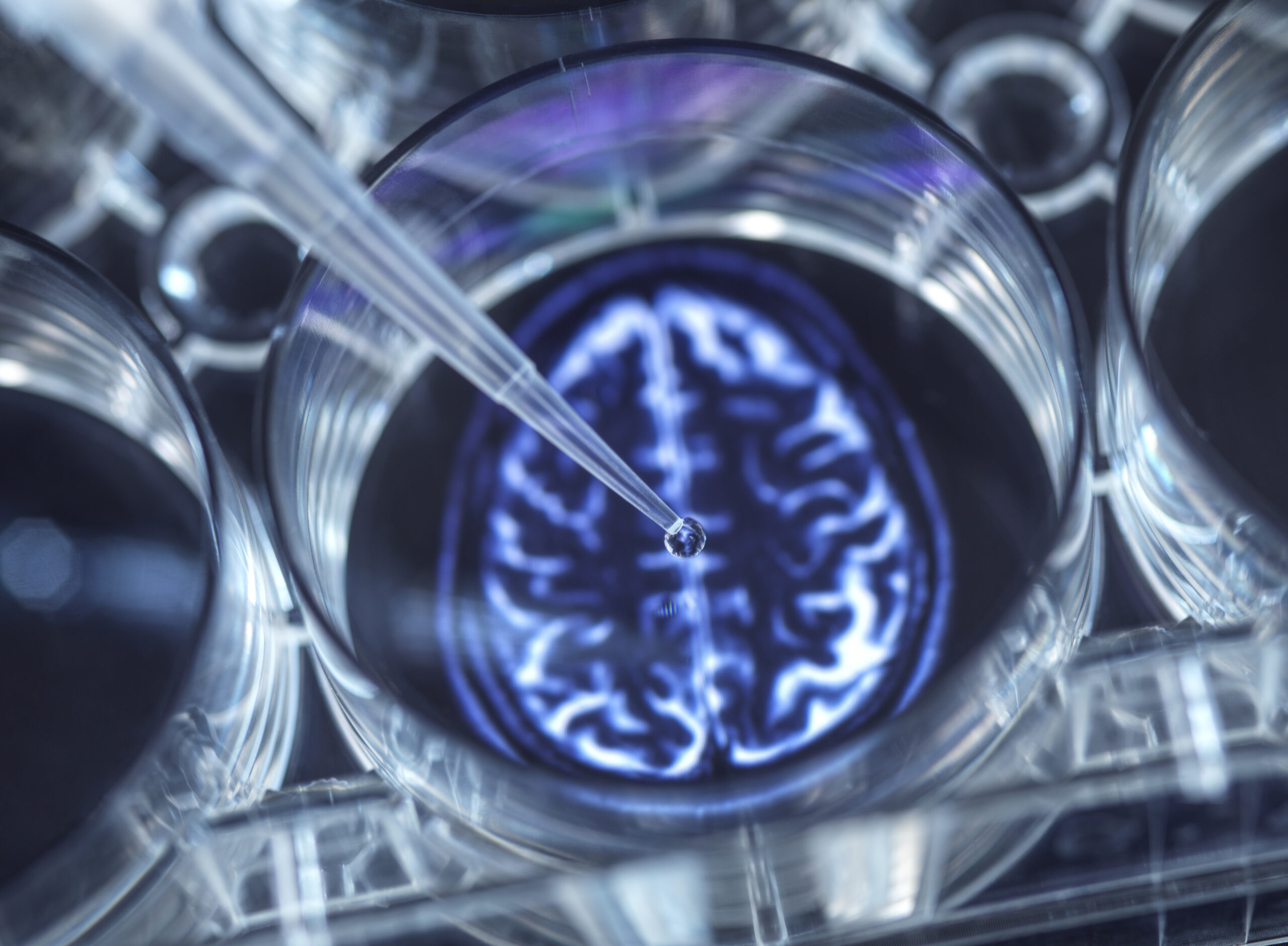 Pipetting potential cure for brain disorders into a multi well plate