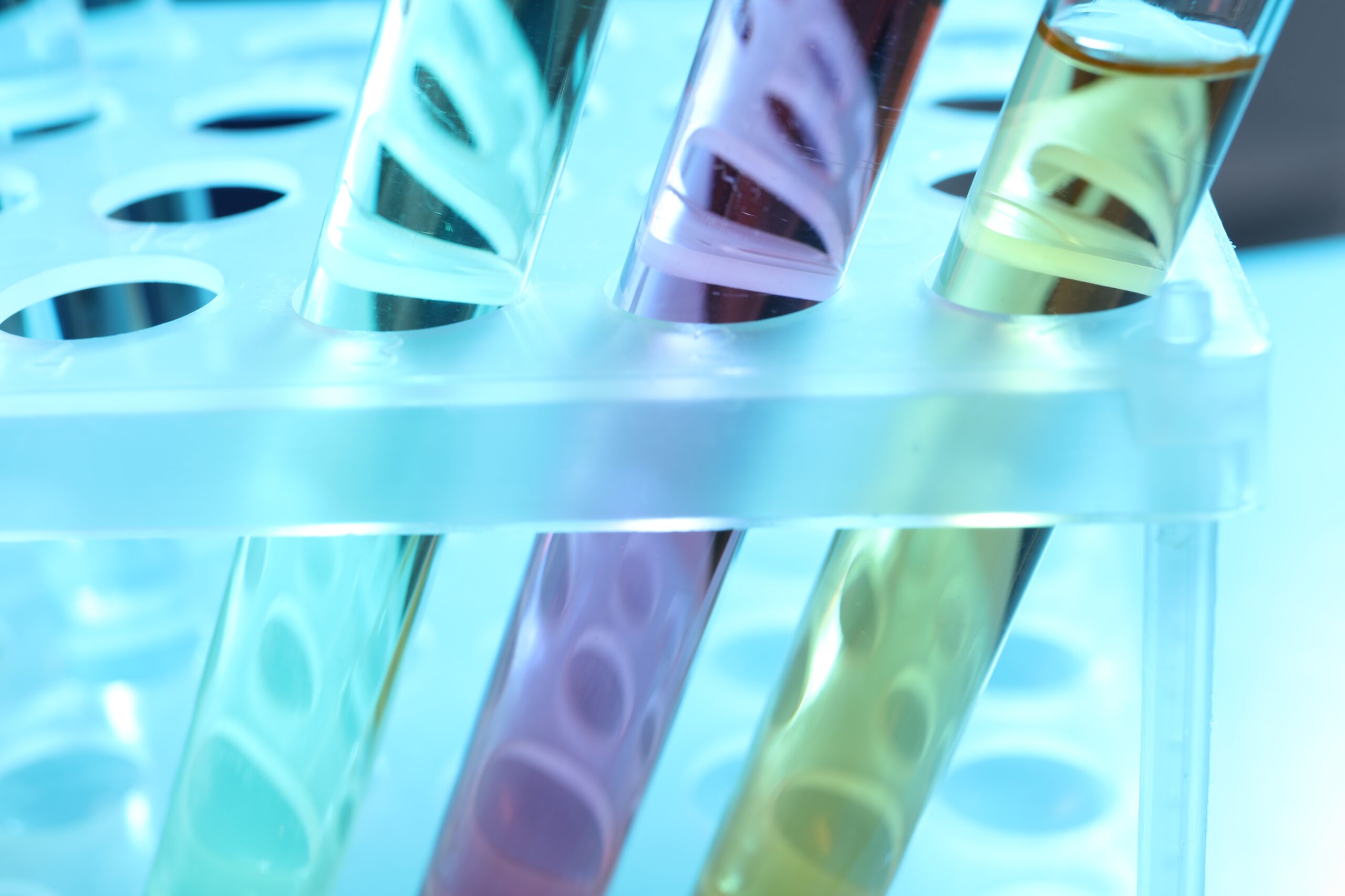 Test tubes with different samples on table, closeup. Solution chemistry